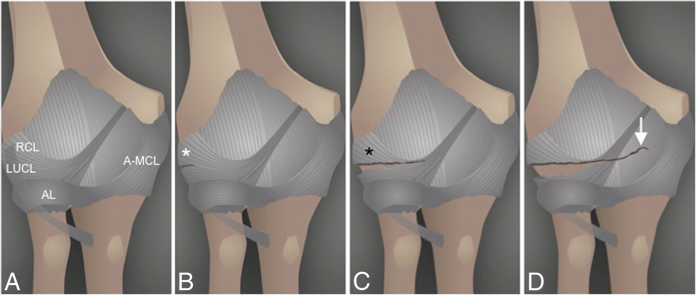 Fig. 22