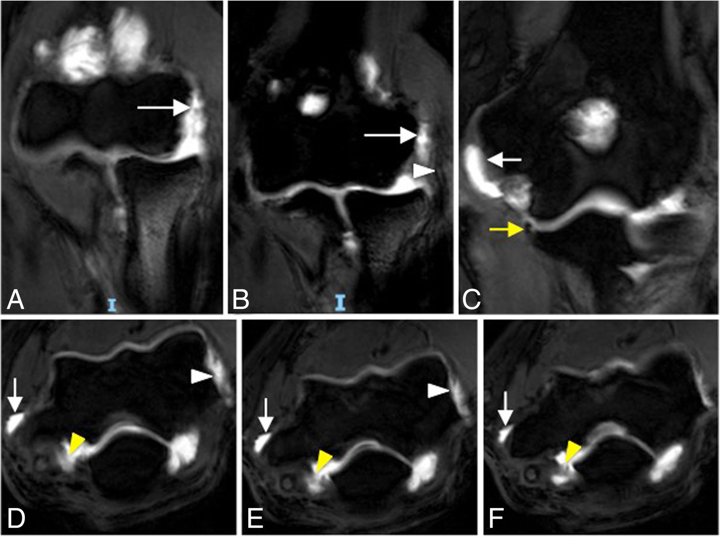 Fig. 28