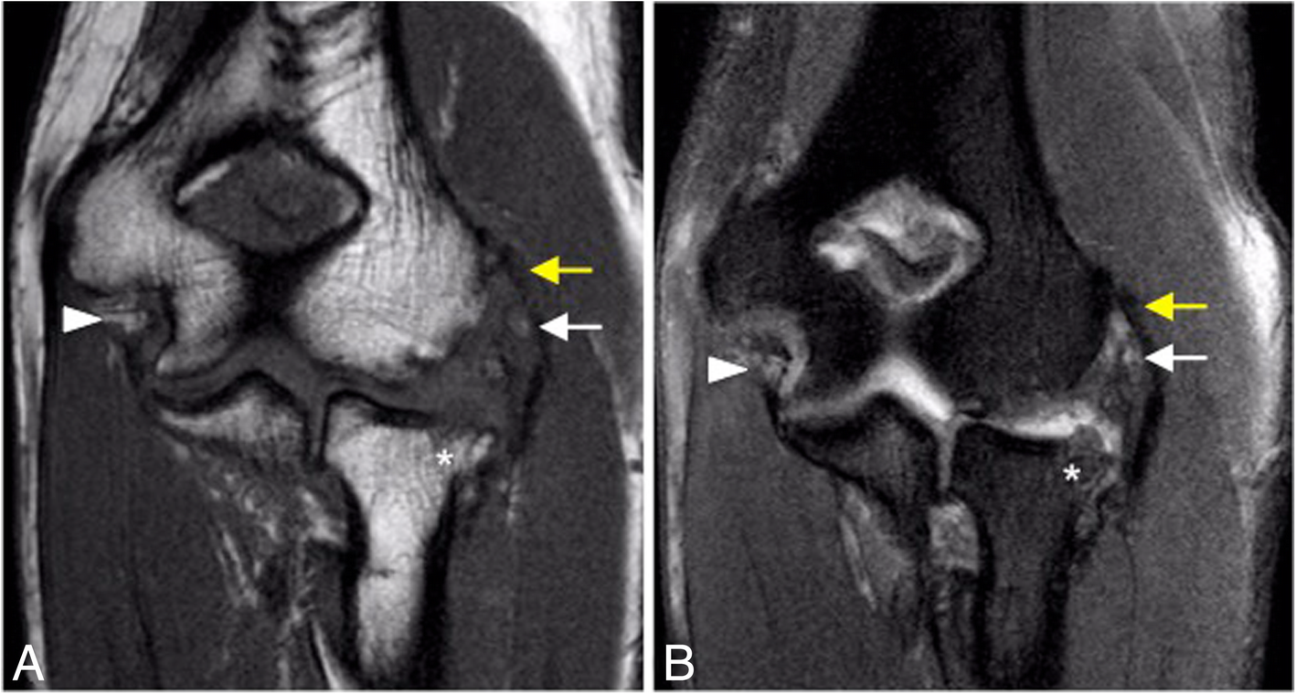 Fig. 31