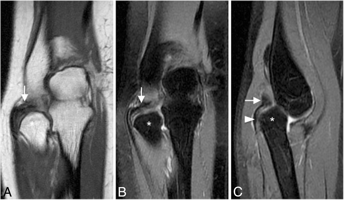 Fig. 33