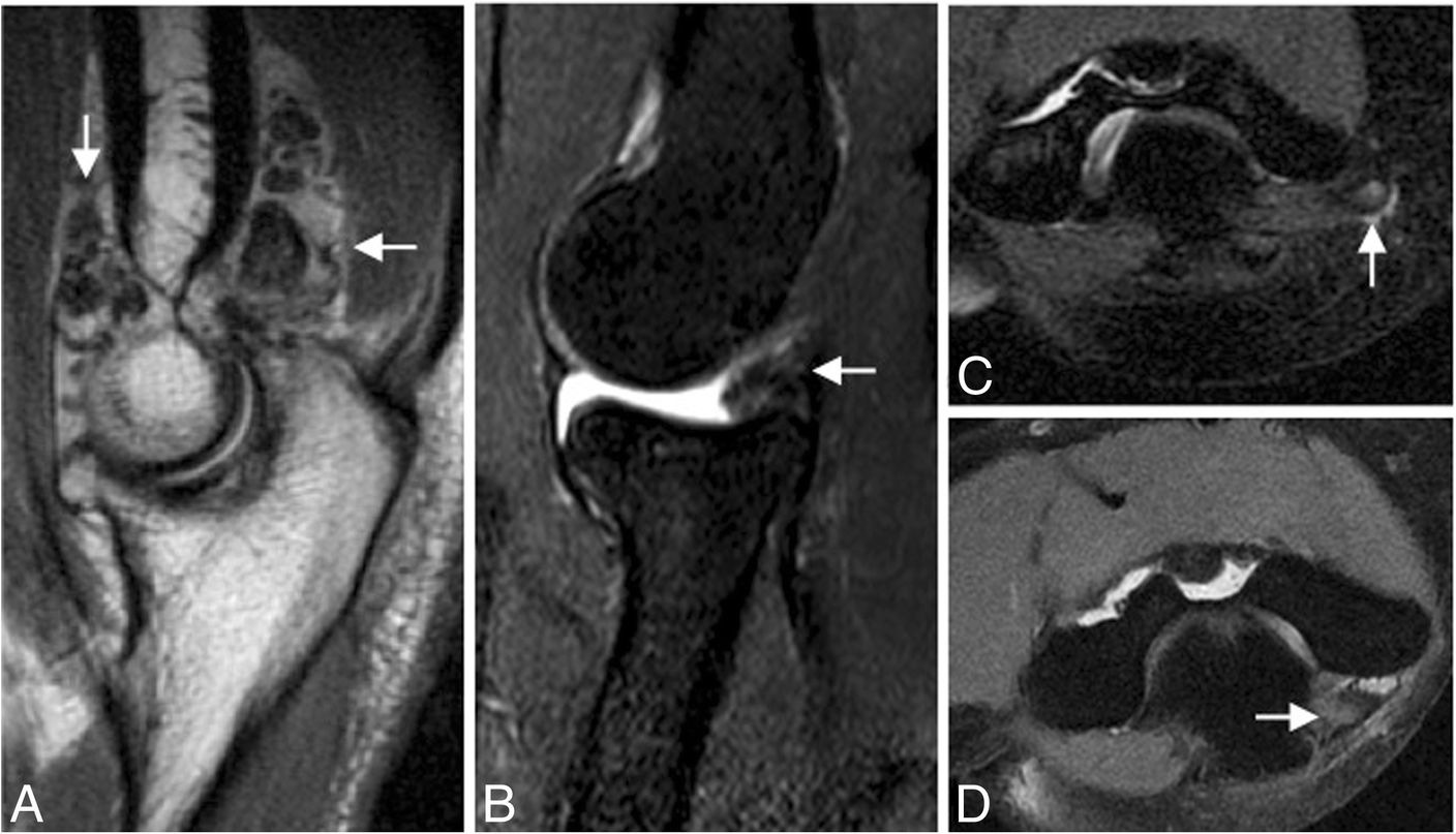 Fig. 34