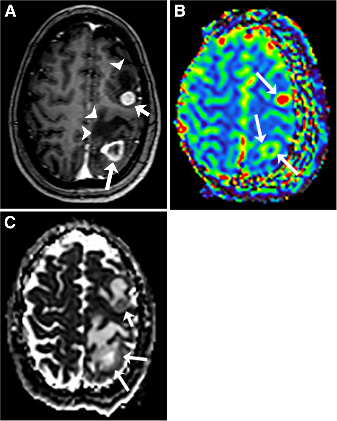 Fig. 11