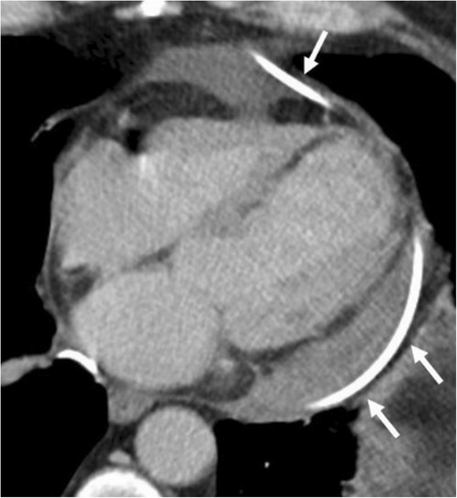 Fig. 21