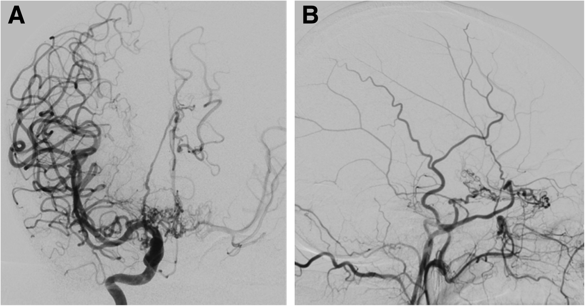 Fig. 19