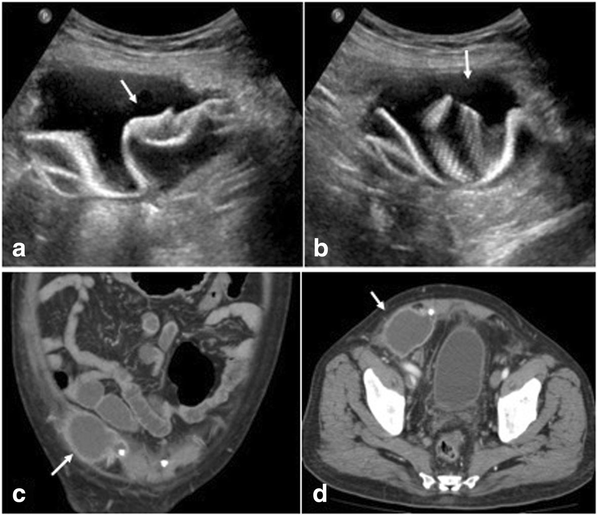 Fig. 12