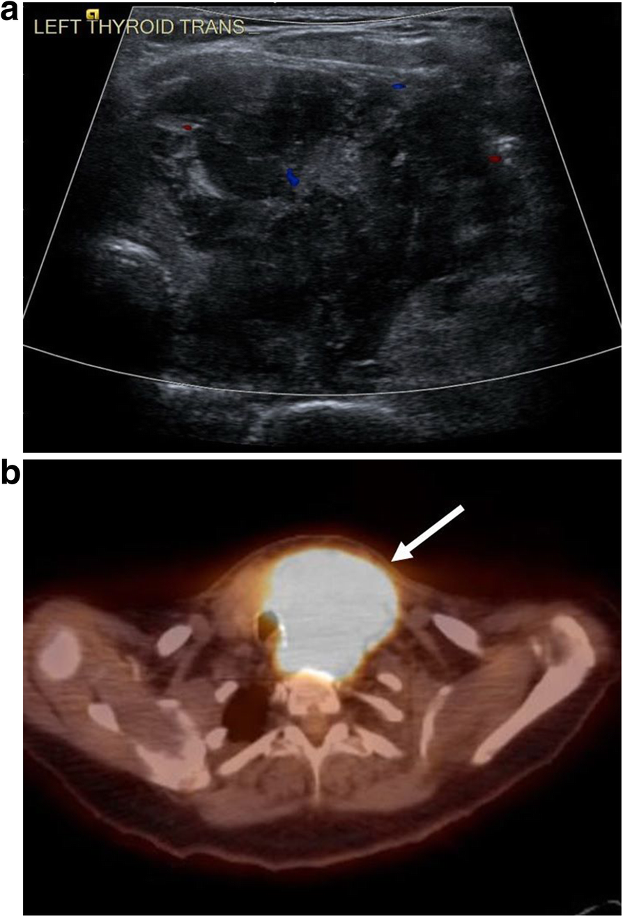 Fig. 11