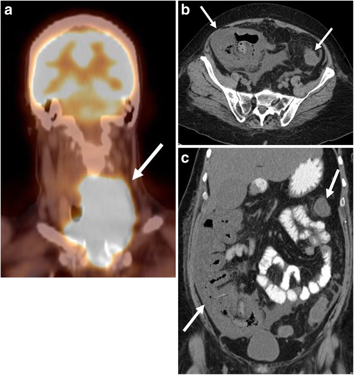 Fig. 16