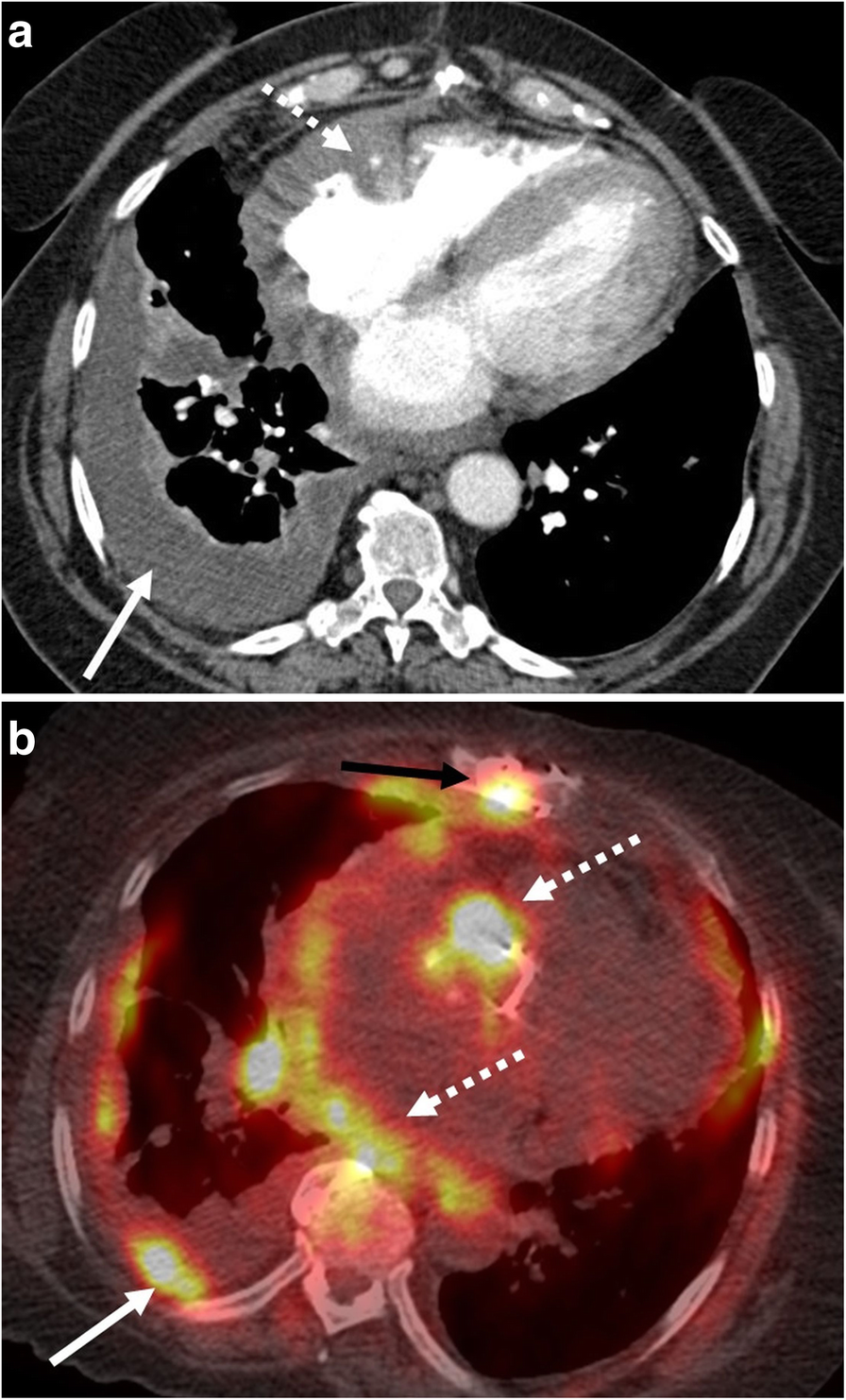 Fig. 9