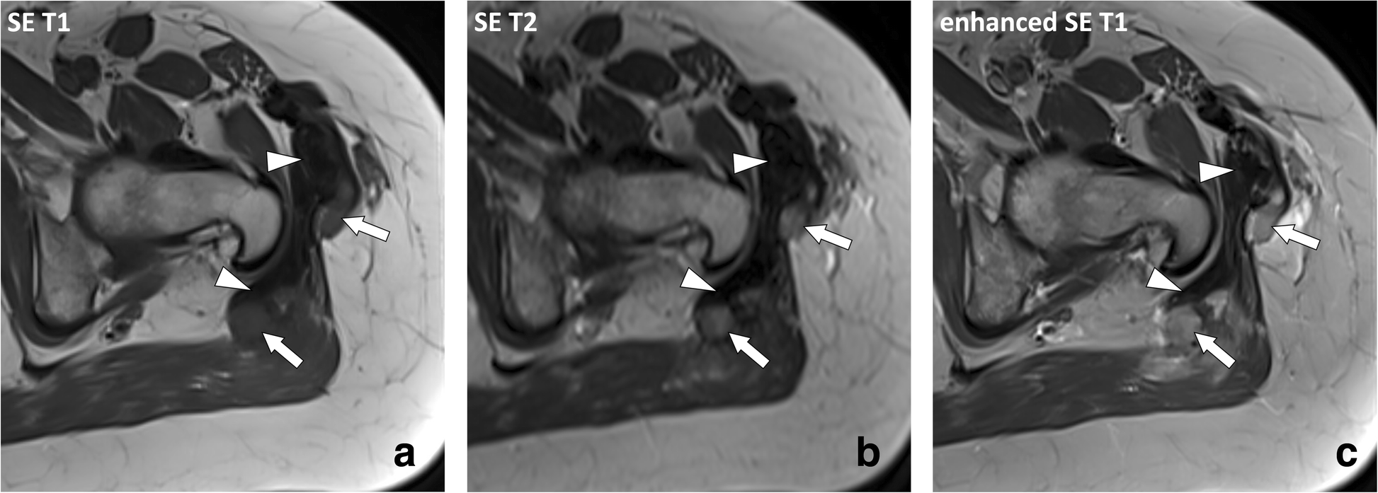 Fig. 15