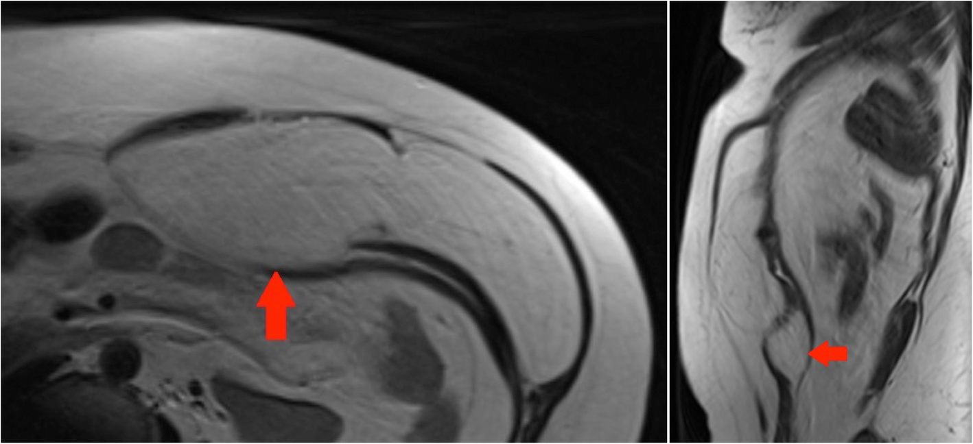 Fig. 11