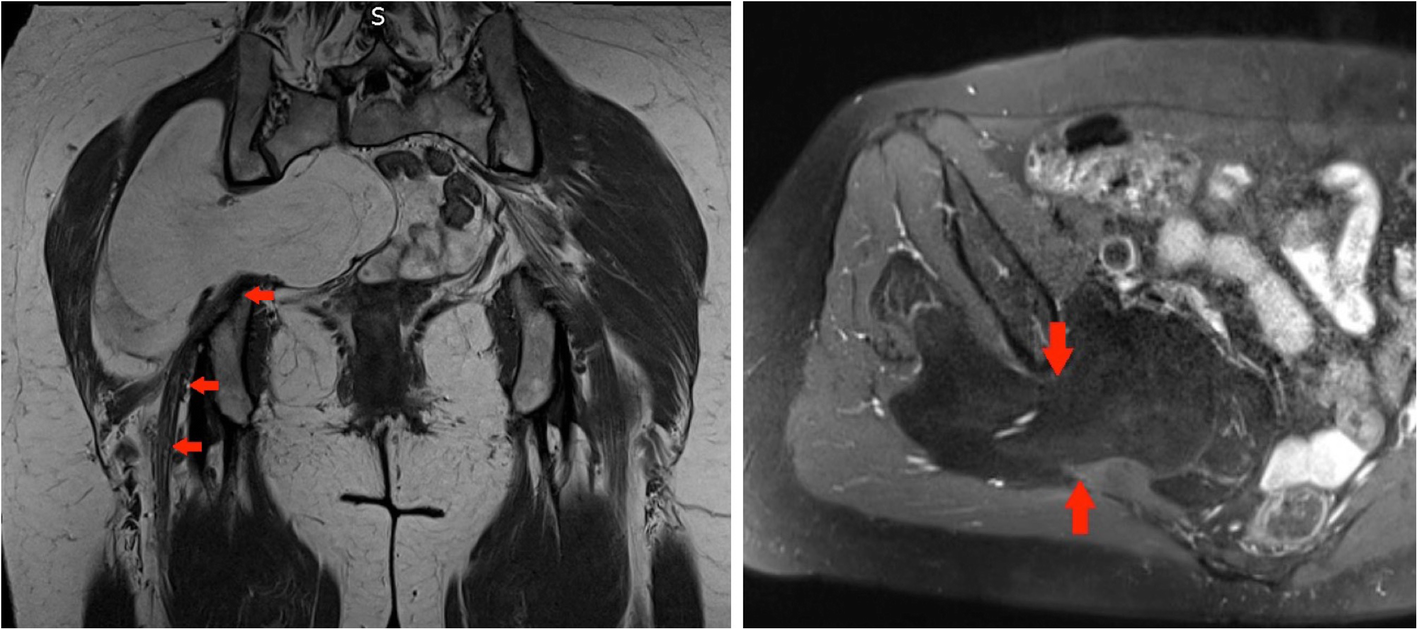 Fig. 12