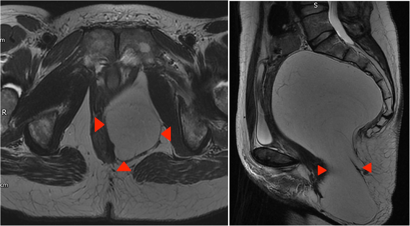 Fig. 13