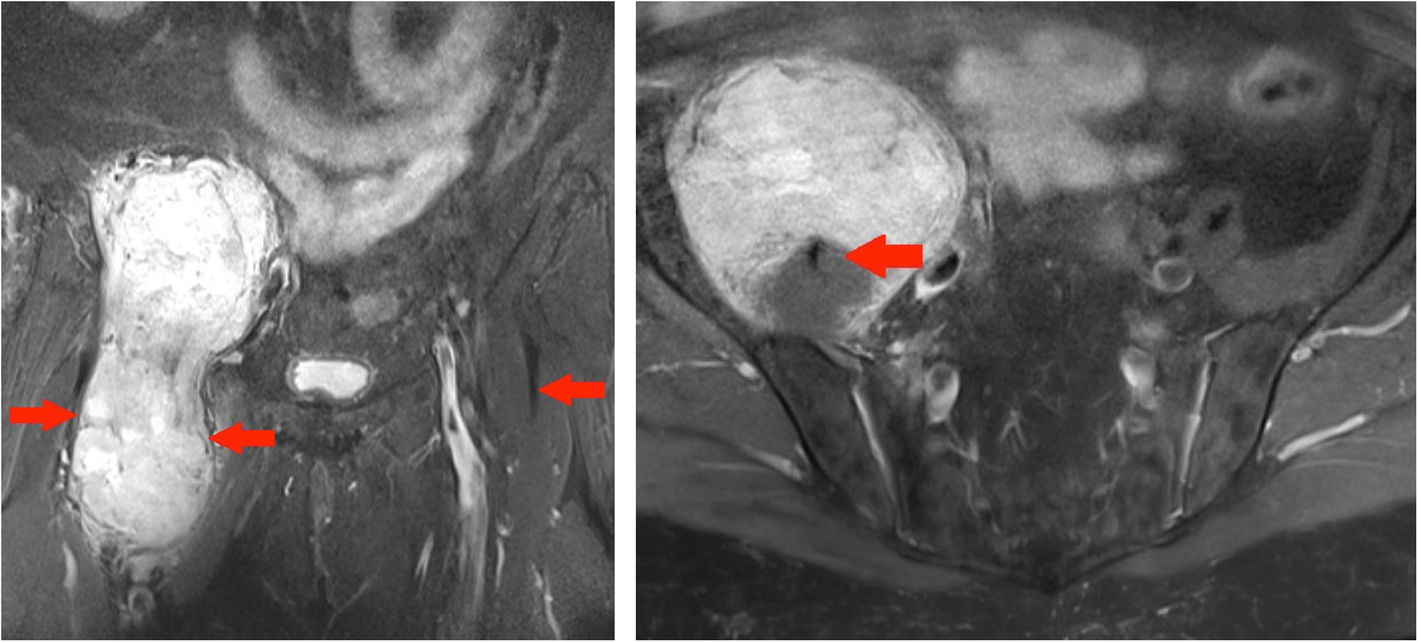 Fig. 15