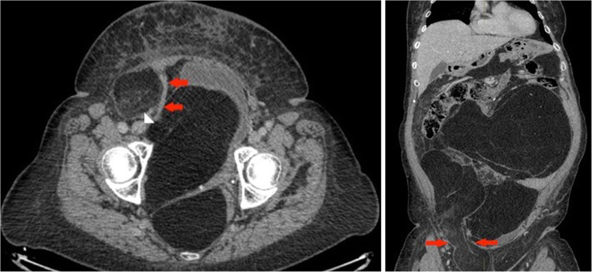 Fig. 2