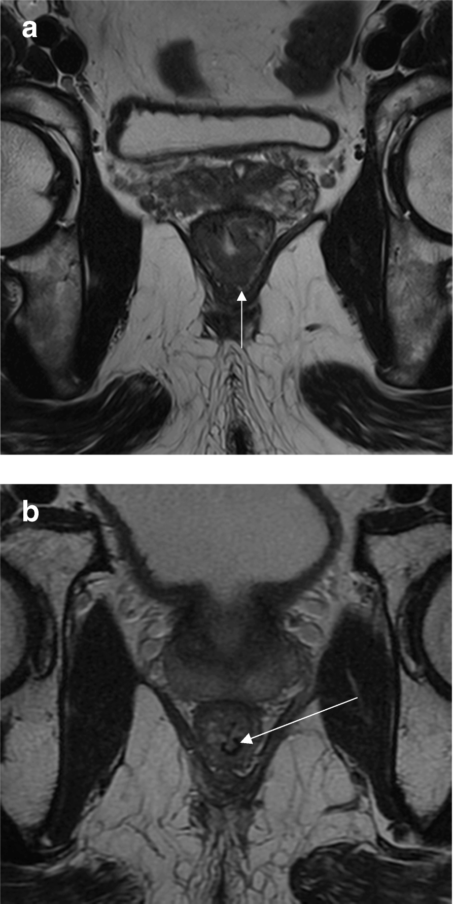 Fig. 10