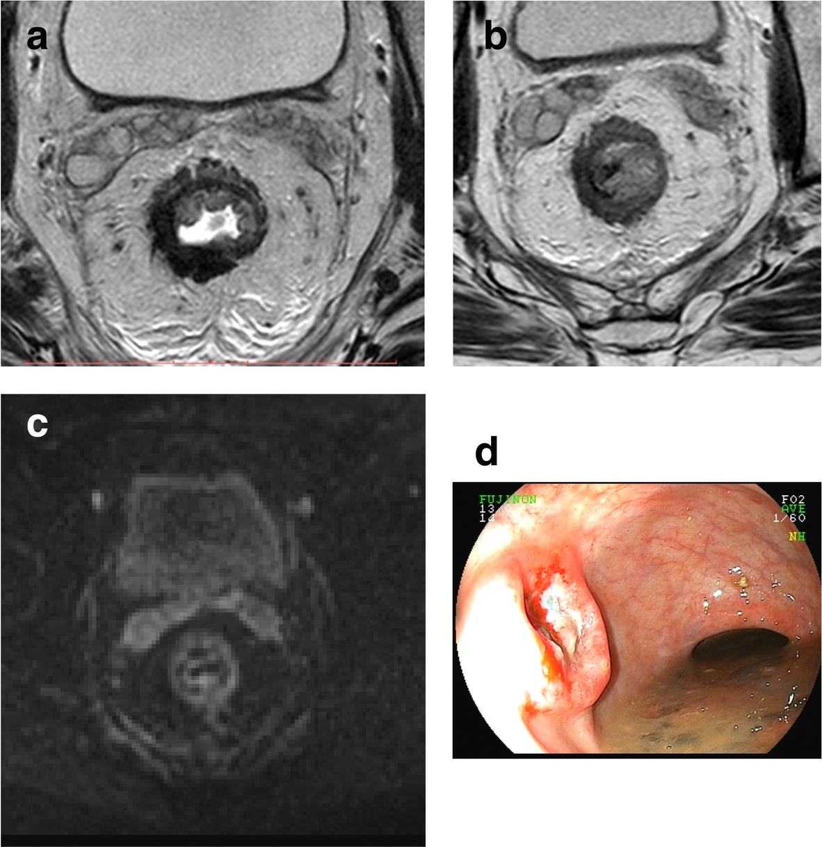 Fig. 14