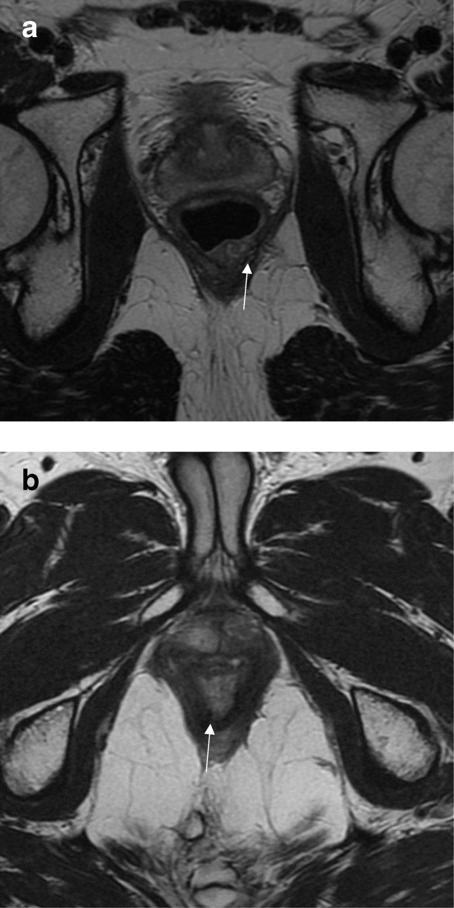 Fig. 17