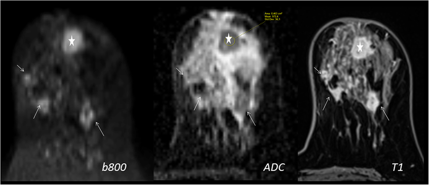 Fig. 9