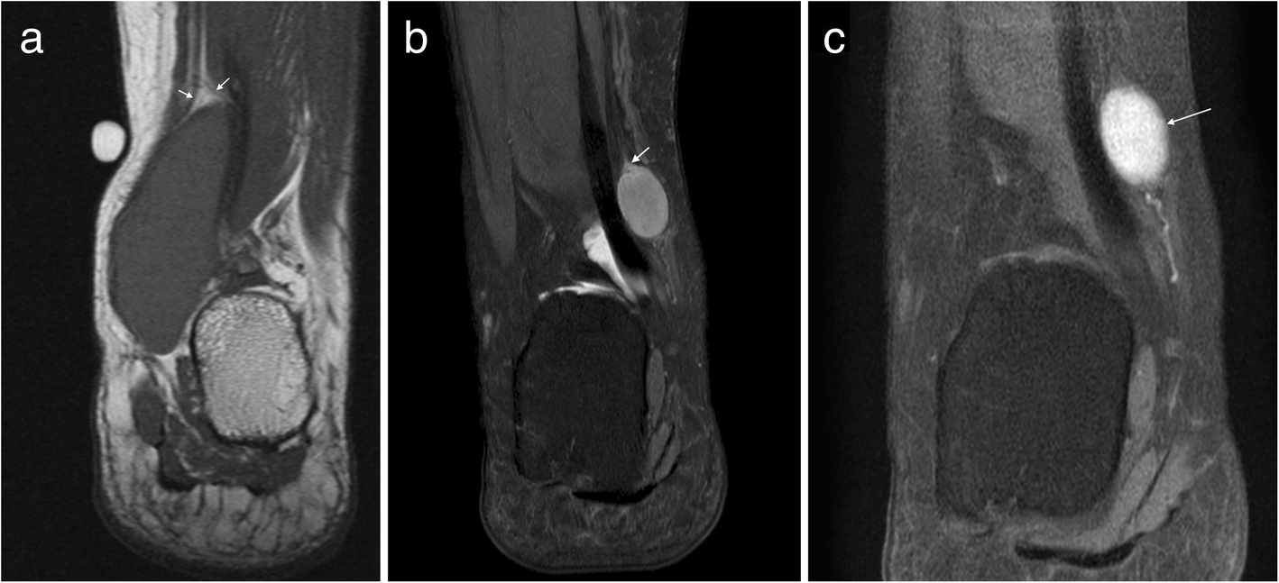 Fig. 10