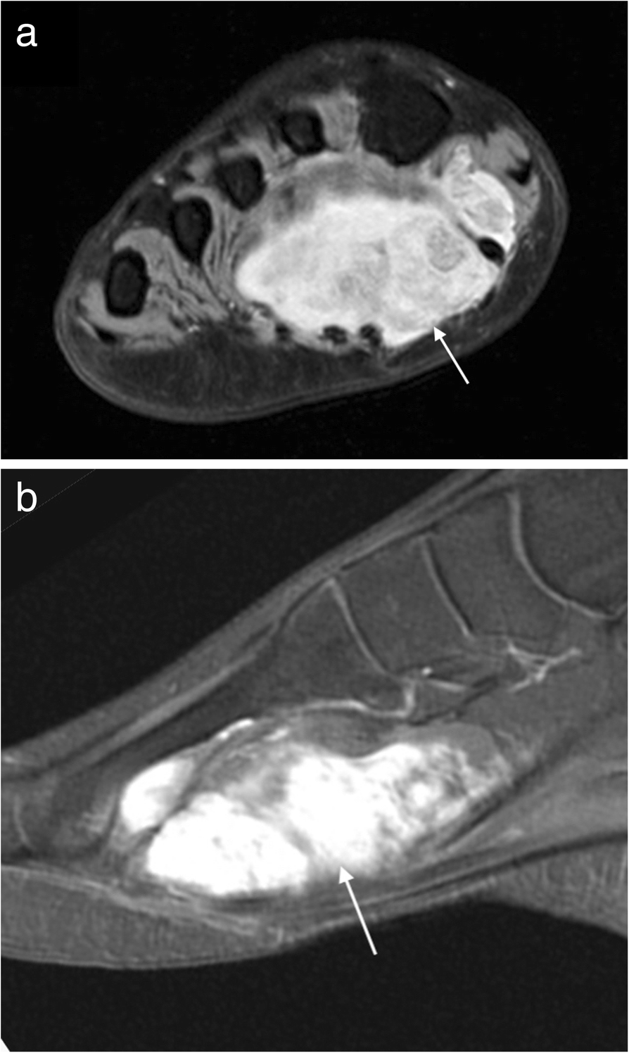 Fig. 11