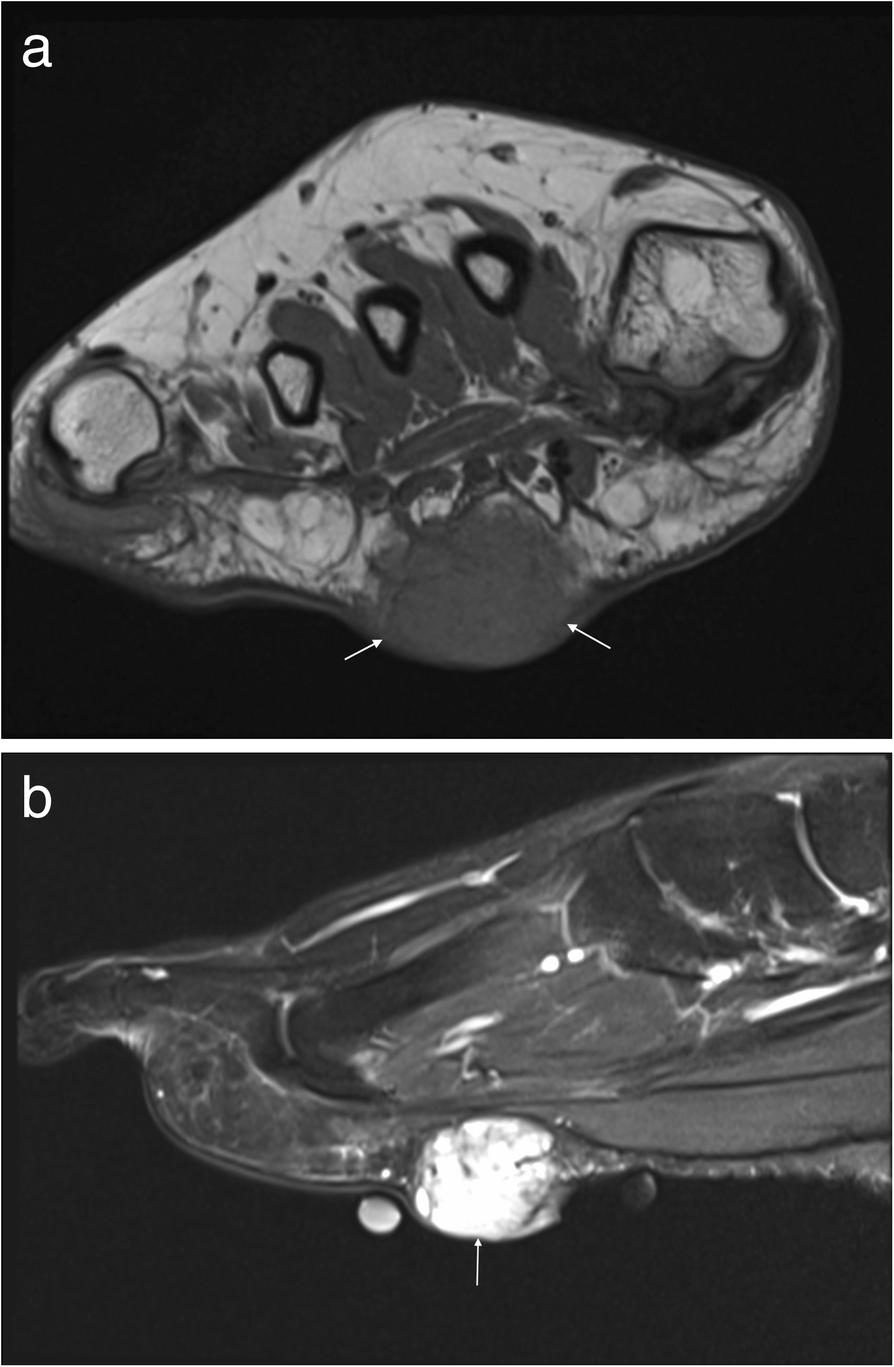 Fig. 14