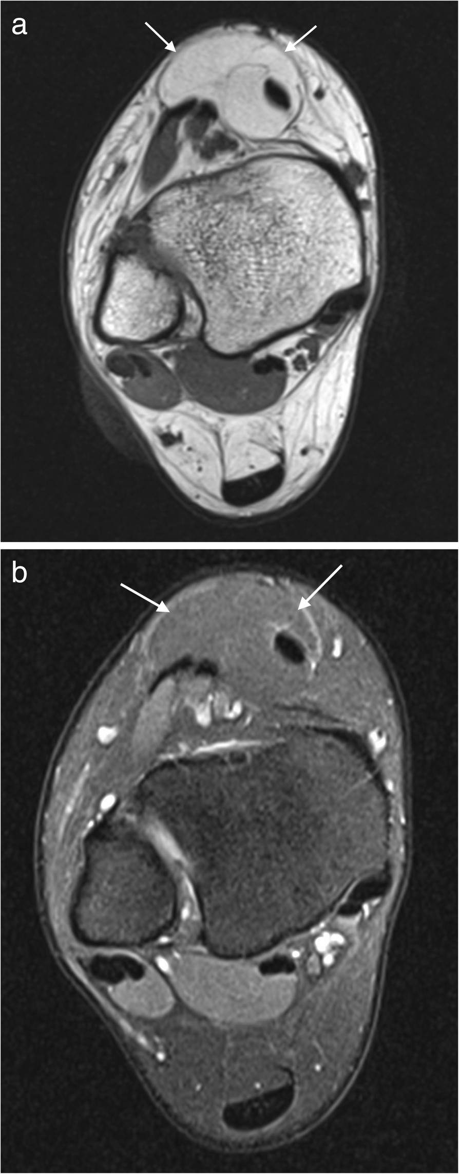 Fig. 5