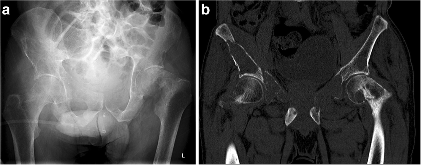 Fig. 13