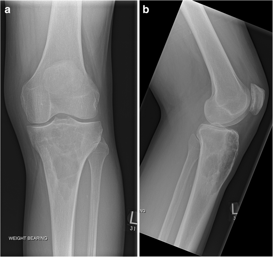 Fig. 15