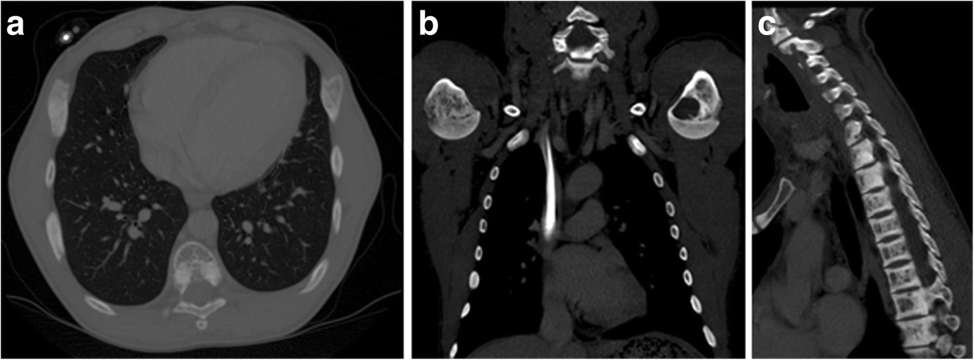 Fig. 18