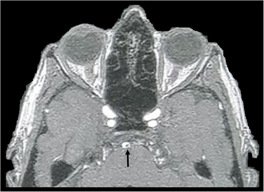 Fig. 24