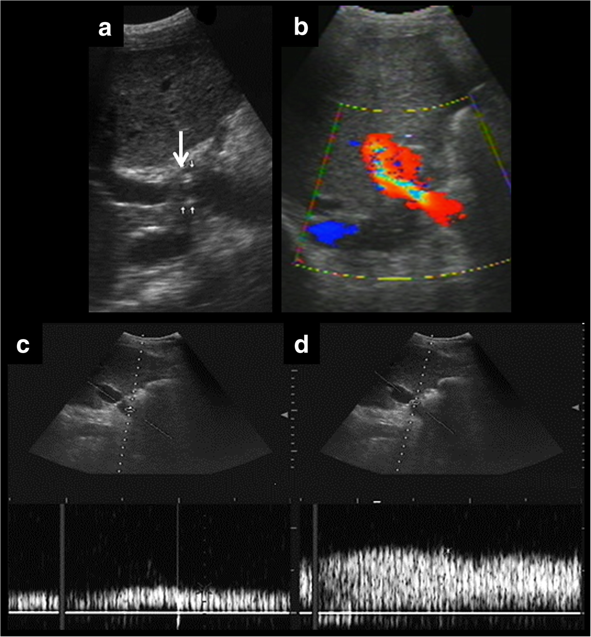 Fig. 10