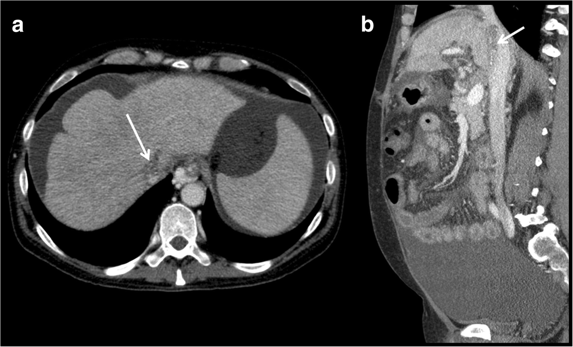 Fig. 13