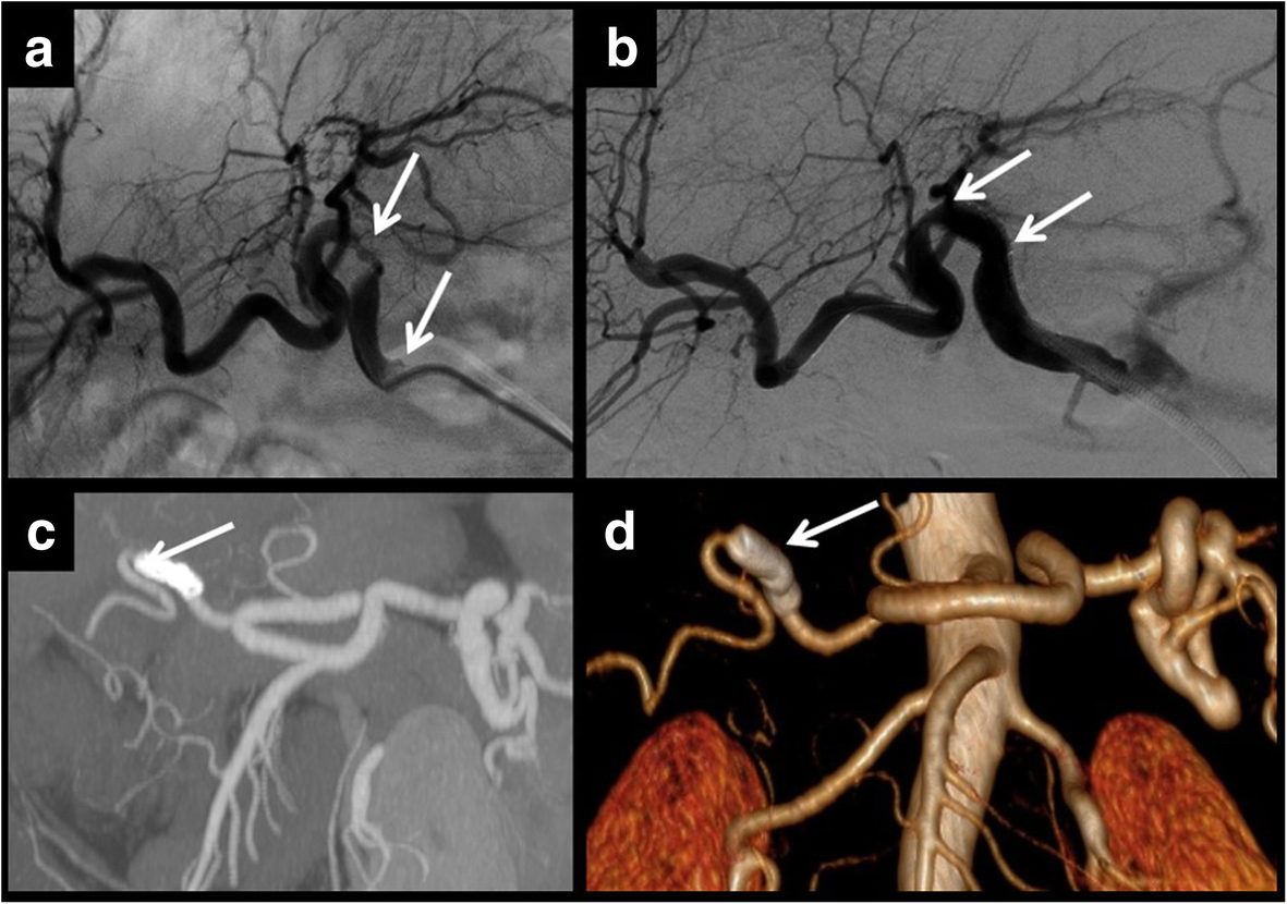 Fig. 5