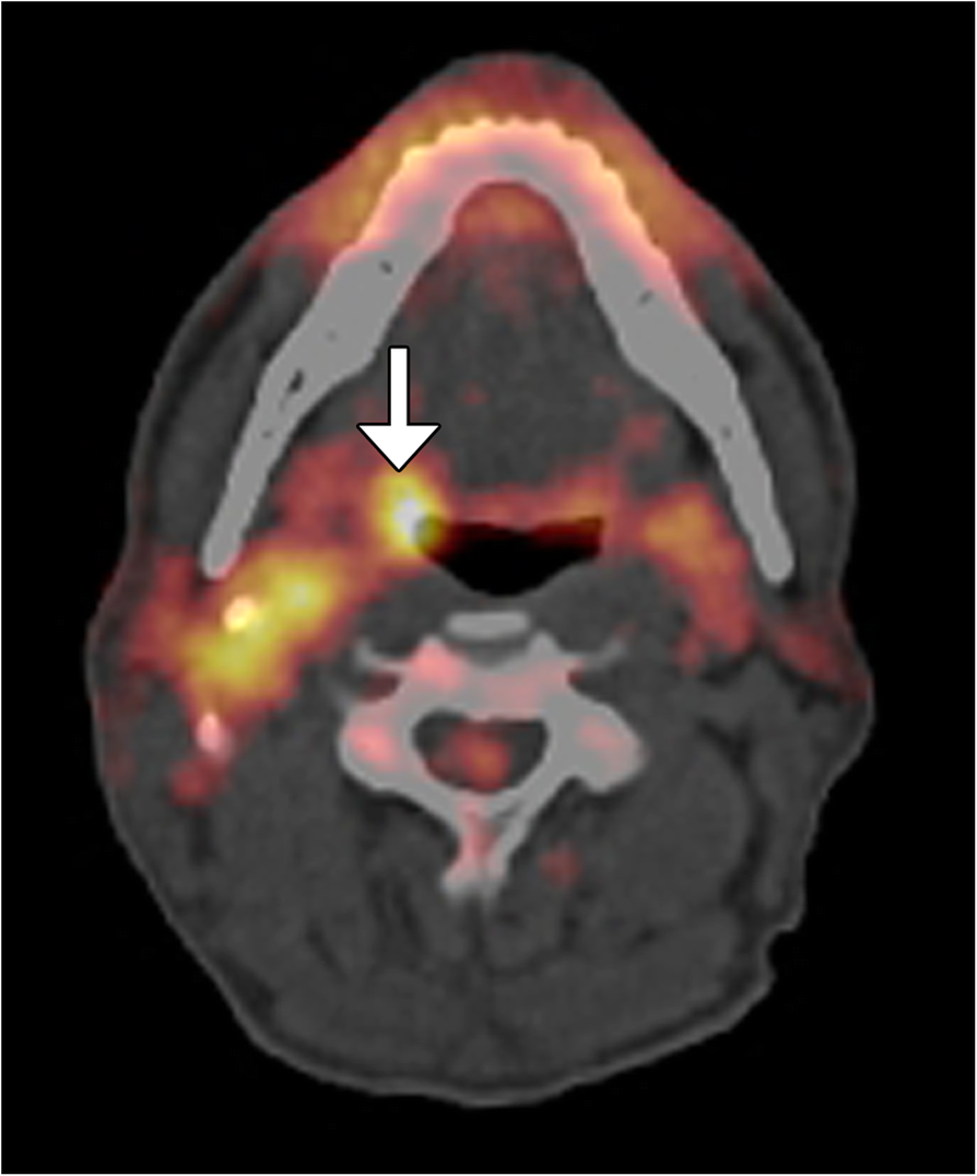 Fig. 12