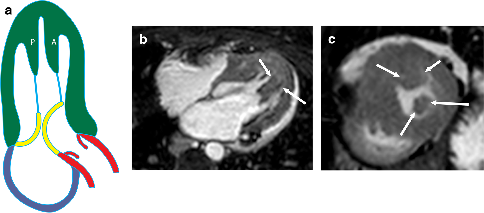 Fig. 12