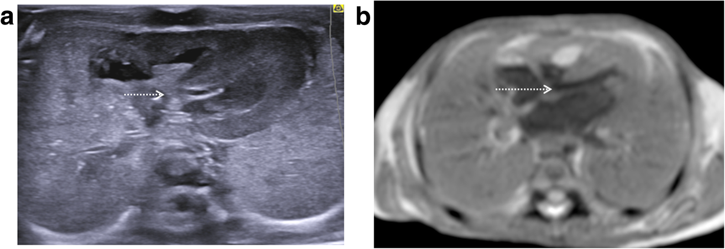 Fig. 11