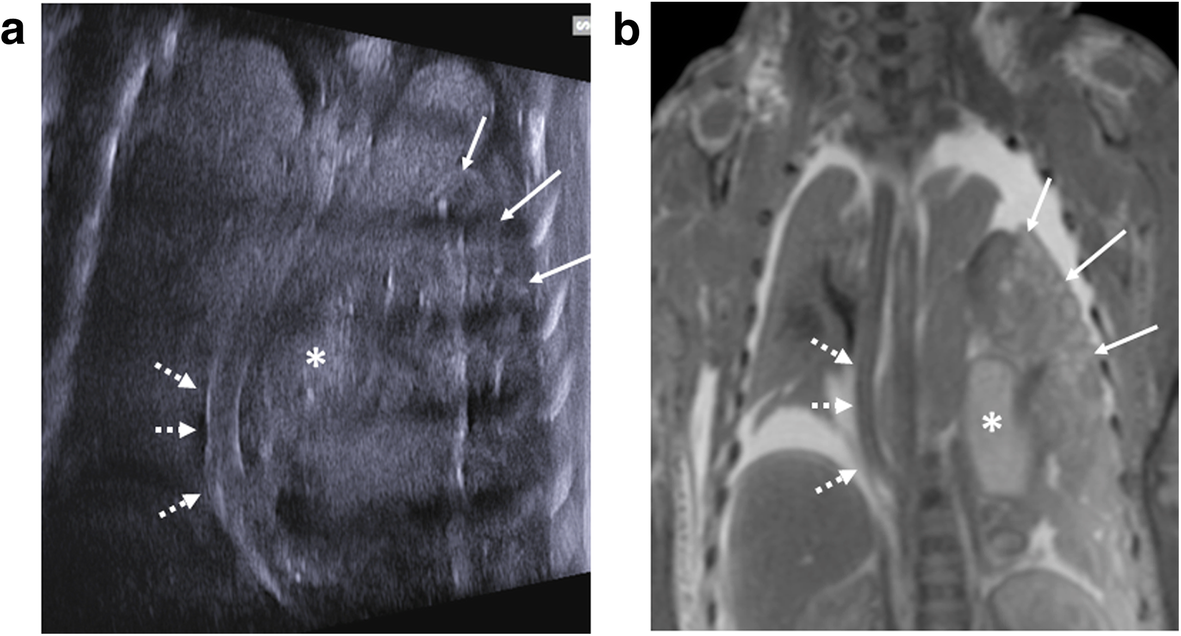 Fig. 12