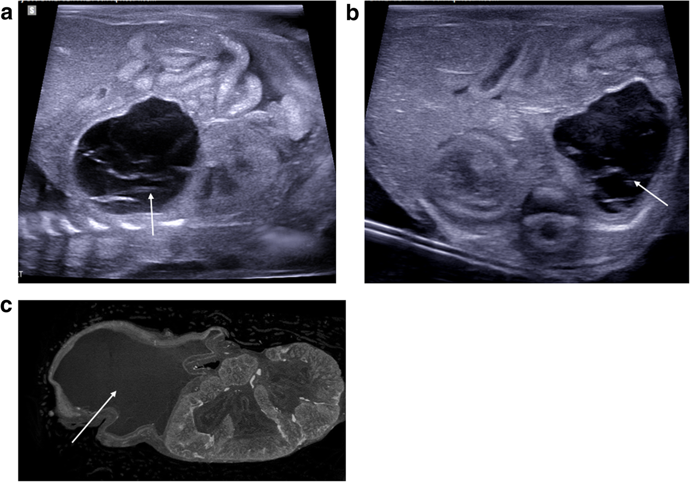 Fig. 15