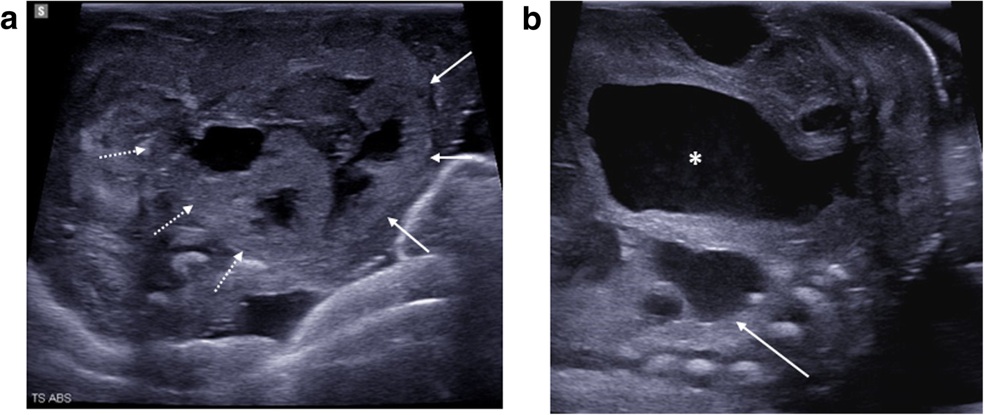 Fig. 22