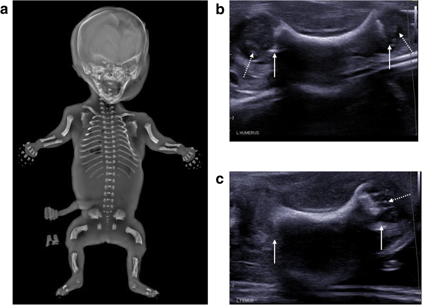 Fig. 23