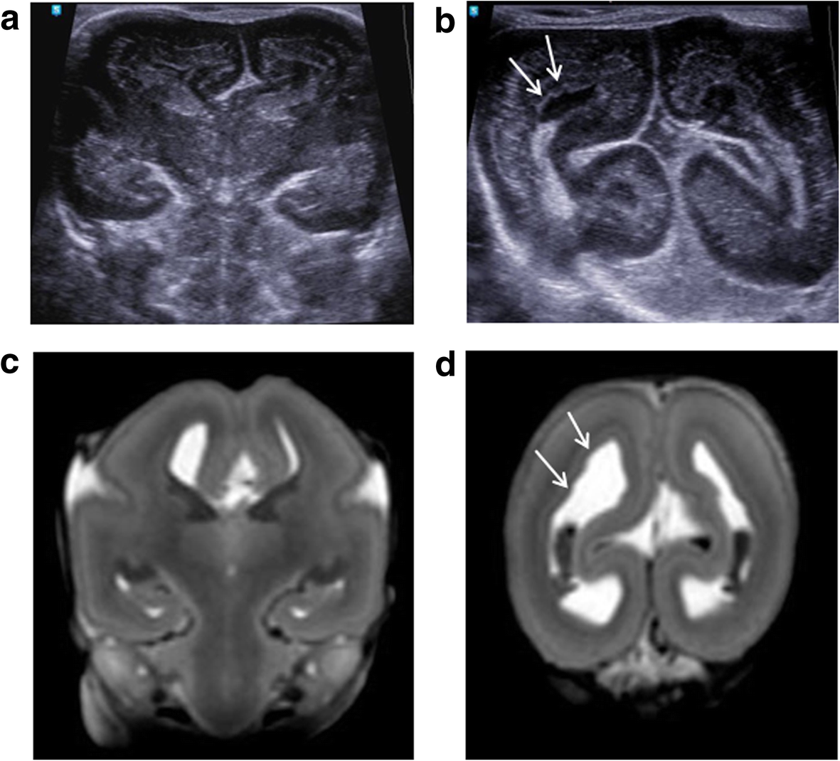 Fig. 5