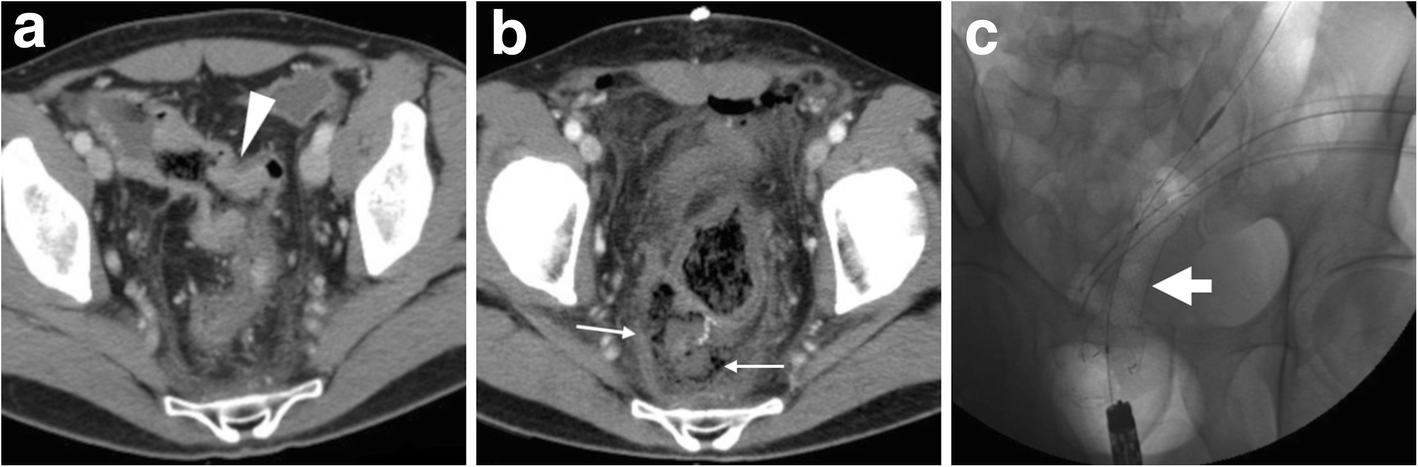 Fig. 11