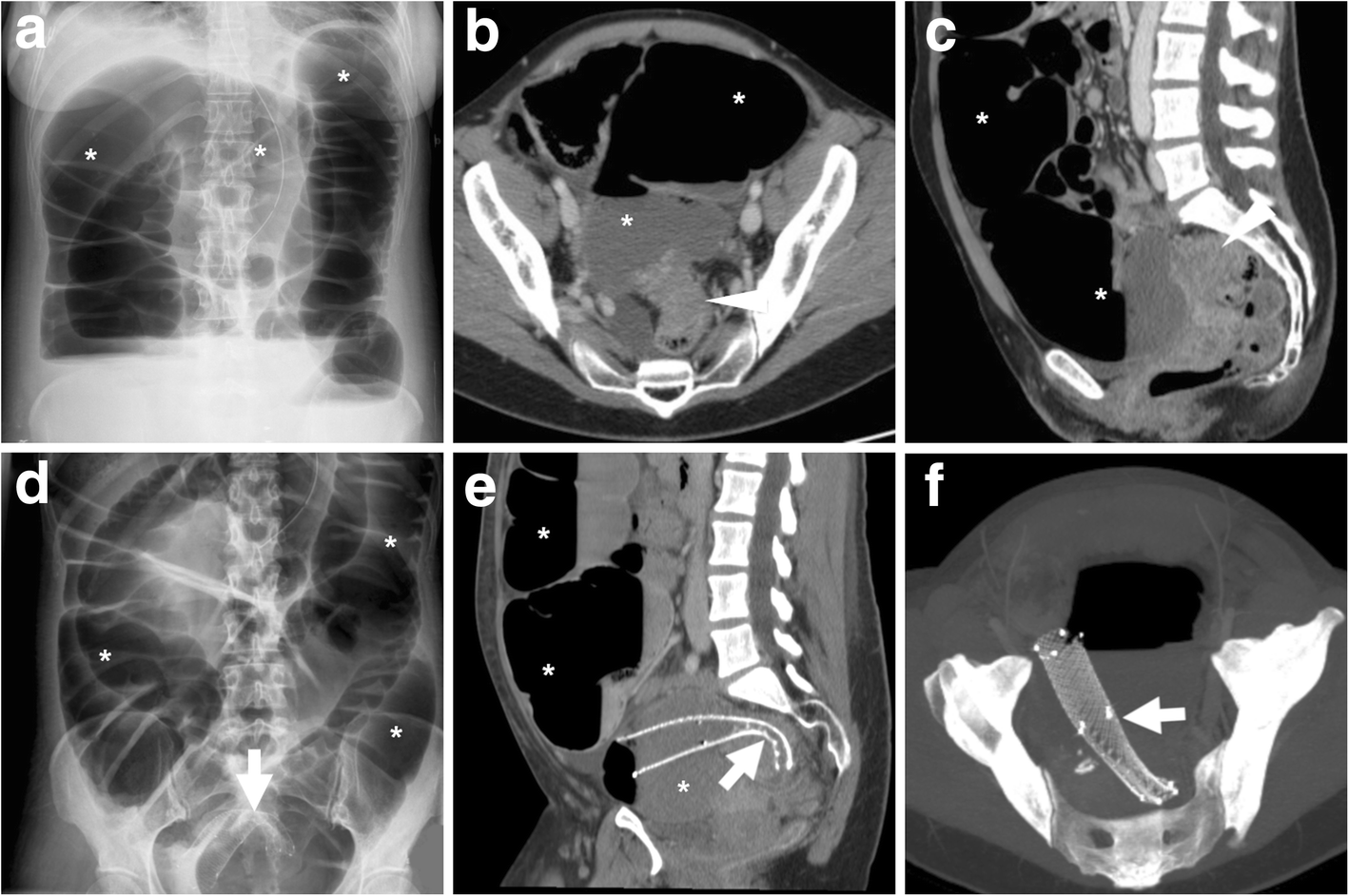 Fig. 15