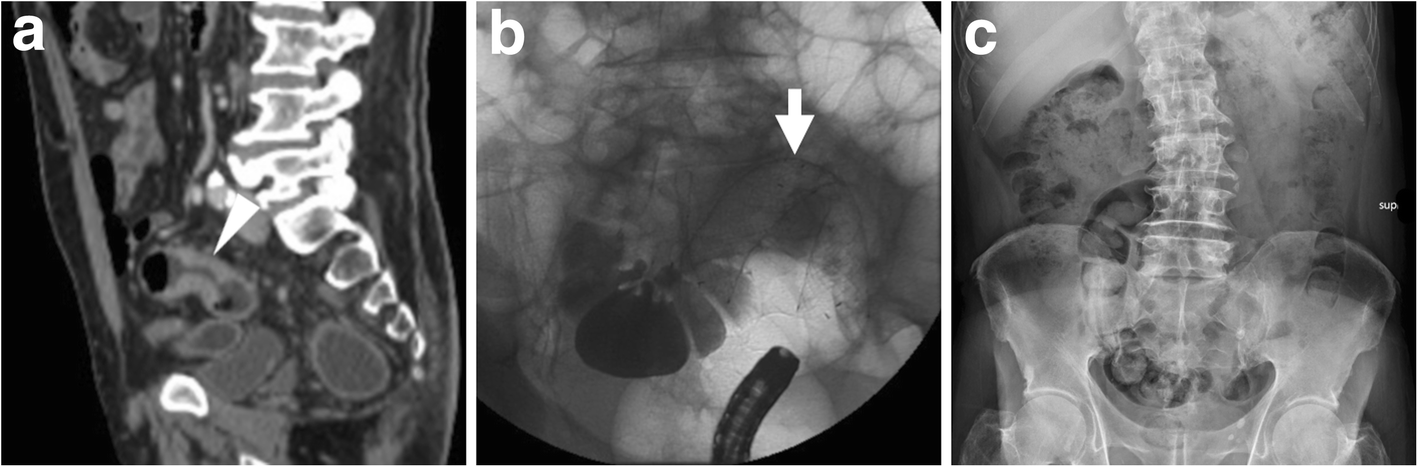 Fig. 17