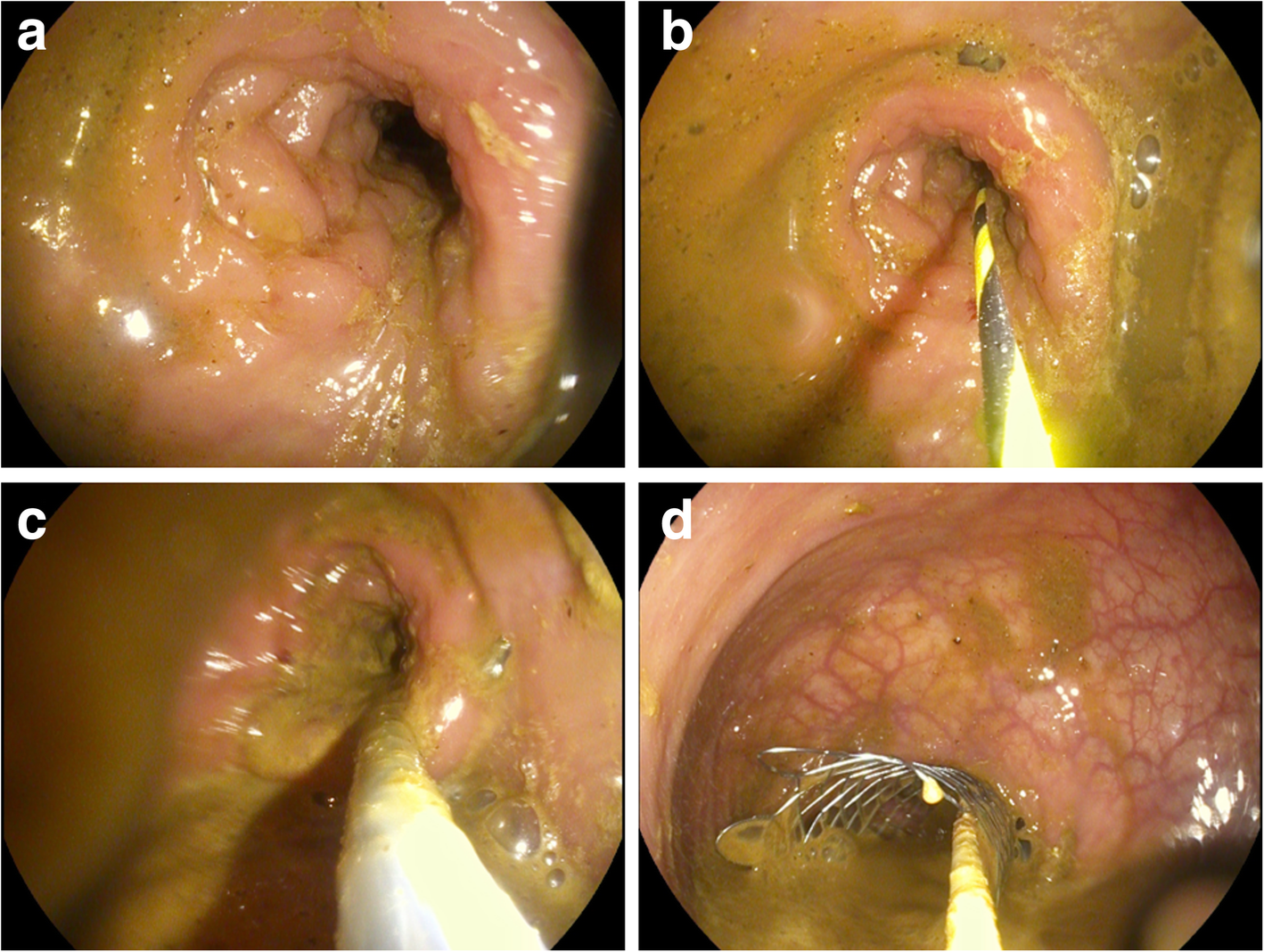 Fig. 2