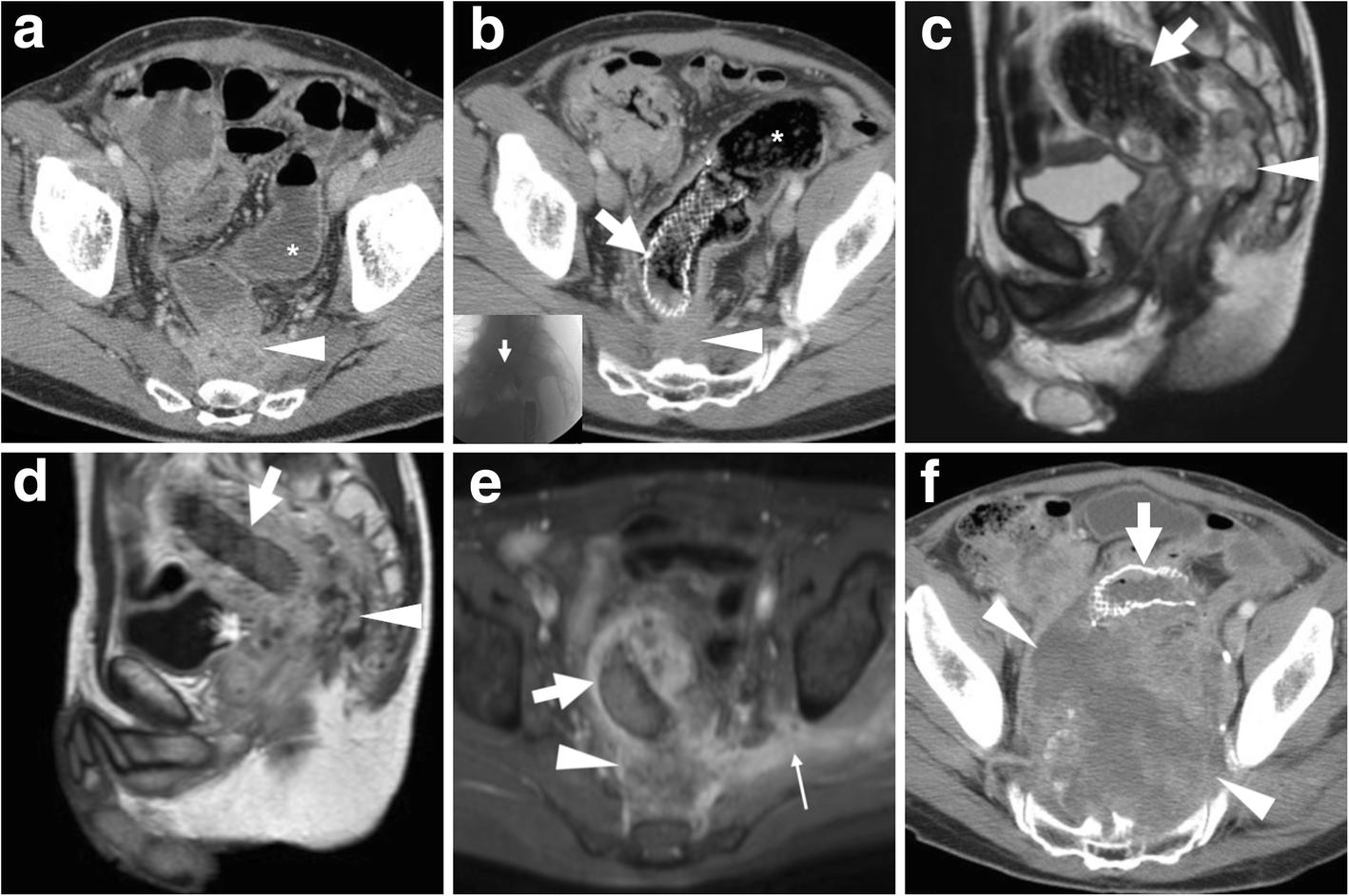 Fig. 9