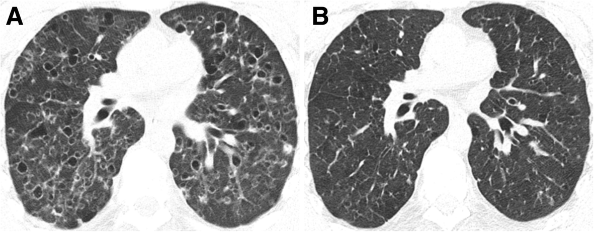 Fig. 12