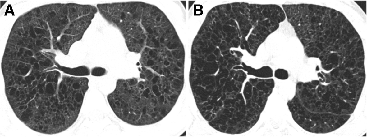 Fig. 13