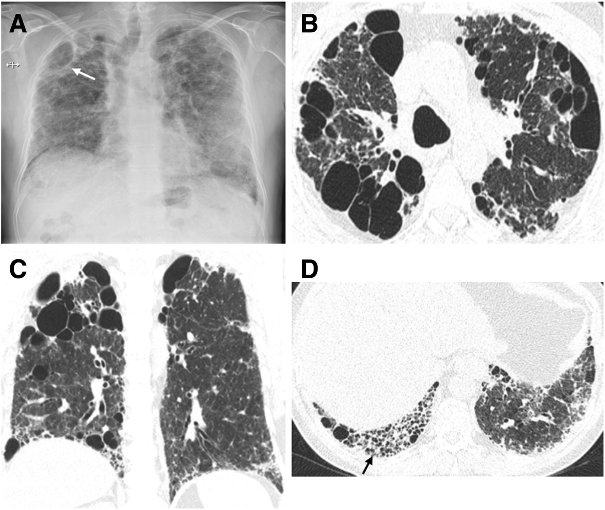 Fig. 20