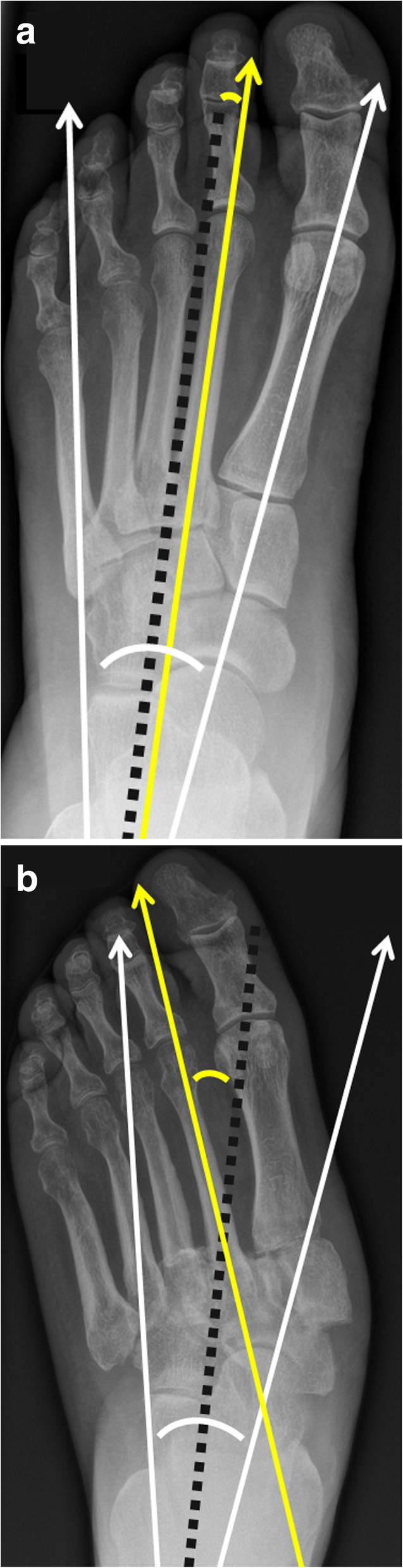 Fig. 11